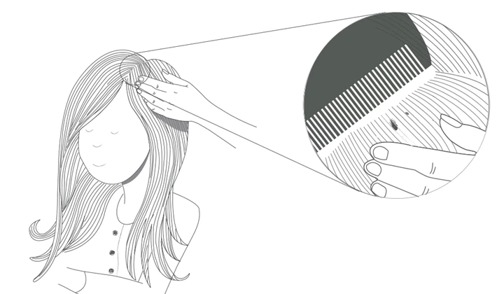 Kammen is belangrijk om een hoofdluisbesmetting te ontdekken Wat te doen bij hoofdluis? Kammen natuurlijk